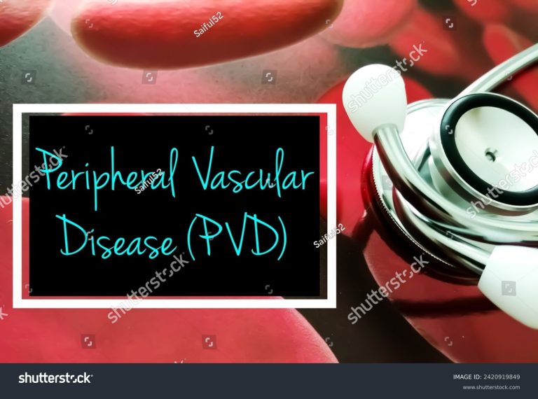 Peripheral Vascular Disease